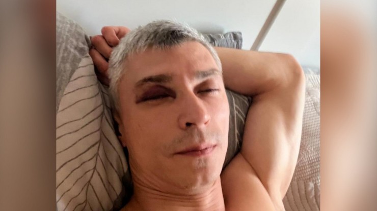"Нам всё равно ничего не будет": на паралимпийца Антона Федулова напали в Твери - новости ТИА