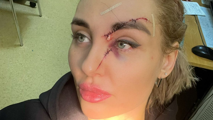 В Твери в ресторане женщина бокалом порезала лицо посетительнице - новости ТИА