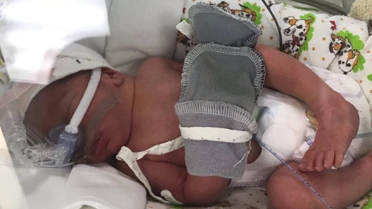 В тверском перинатальном центре за год спасли 402 недоношенных малыша - новости ТИА