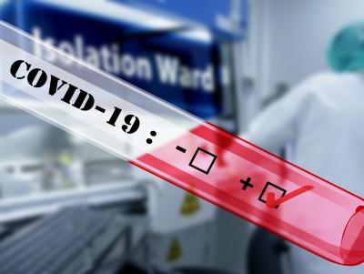 За сутки подтверждено 34 новых случая коронавируса, два человека умерли - Новости ТИА