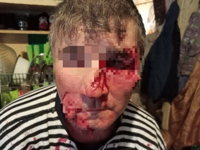 В Тверской области волчица напала на человека: мужчина в тяжёлом состоянии - Новости ТИА