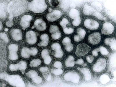 В России выявили первое в мире инфицирование человека гриппом A(H5N8) - новости ТИА