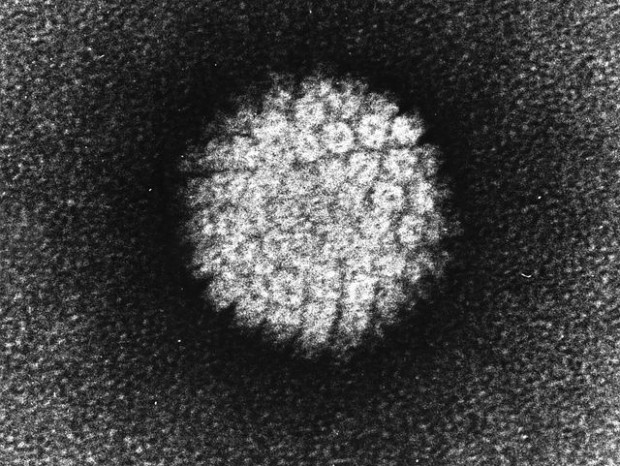 Папилломавирус человека (HPV). Фото: Wikipedia.org