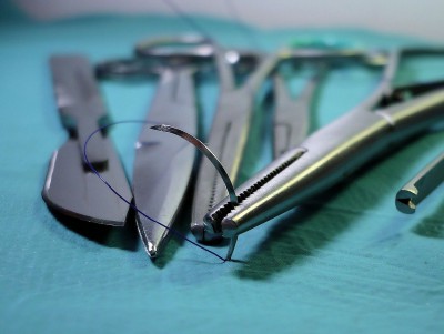 В Твери хирурги достали из бронха четырёхлетней девочки шелуху от семечки - Новости ТИА