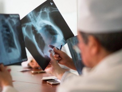 Тверские врачи рассказали, где и как можно "подхватить" туберкулез - новости ТИА