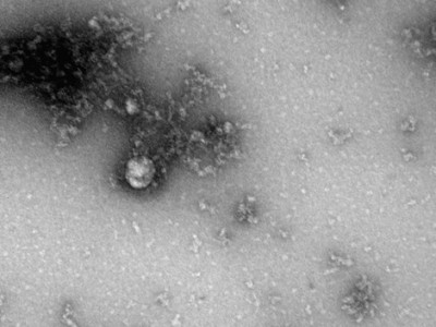 Российские ученые впервые сфотографировали британский штамм коронавируса - новости ТИА