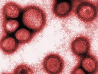 В феврале в  Тверской области медики прогнозируют вспышку гриппа. Свиной - уже пришел - Новости ТИА