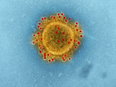 Детский инфекционист ответил на вопросы родителей о вирусе Коксаки - новости ТИА