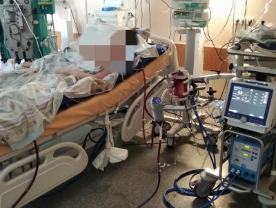 16-летнюю девушку с большим поражением лёгких спасли тверские врачи - Новости ТИА
