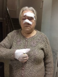 В Твери остановка упала на пожилую женщину - новости ТИА